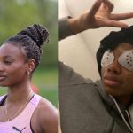 Blessing Enatoh Augenlaser OP