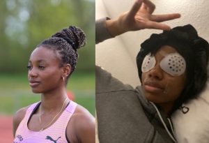 Blessing Enatoh Augenlaser OP
