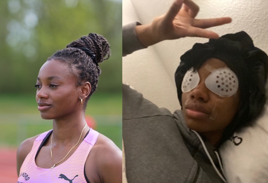 Blessing Enatoh Augenlaser OP